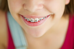 Child-Orthodontics